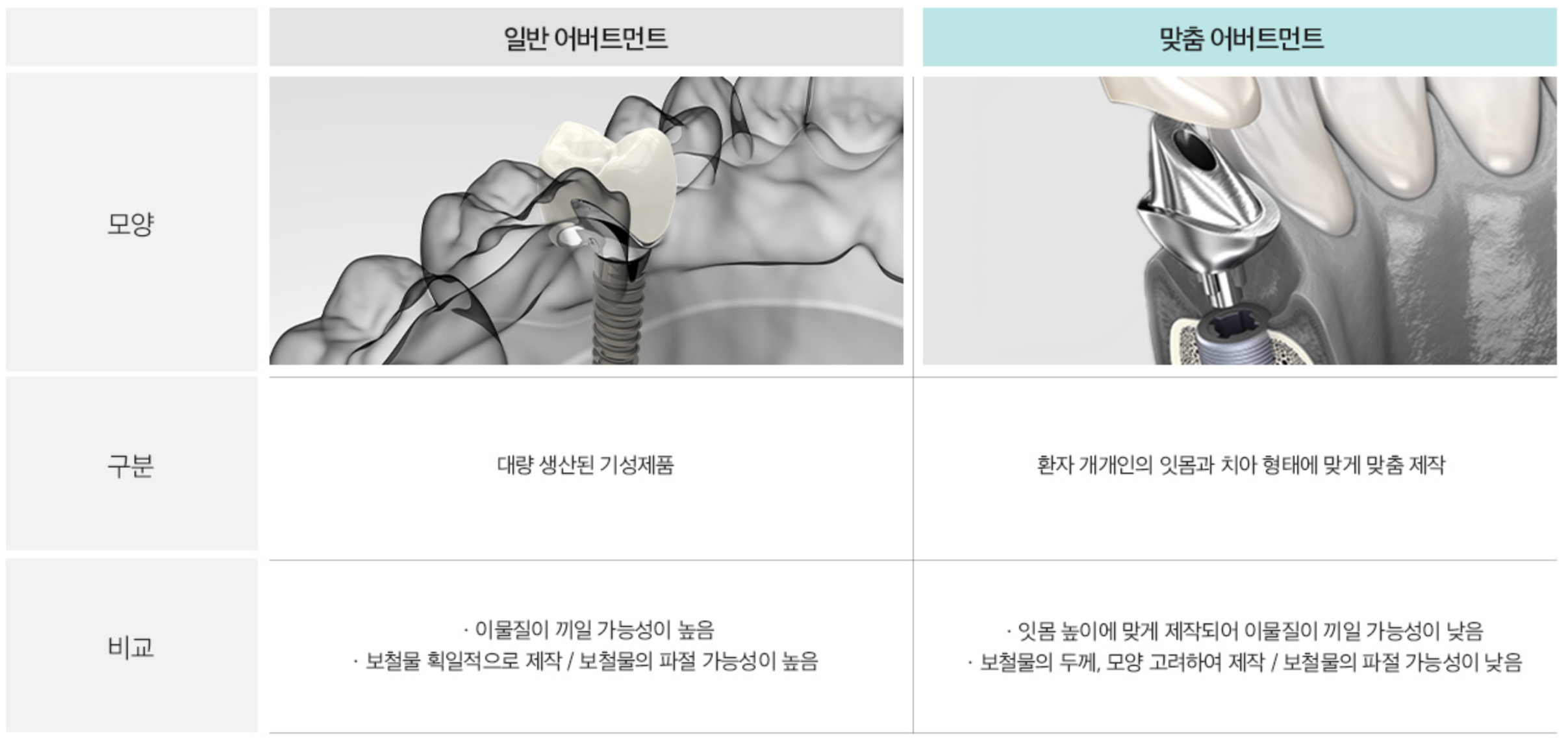 임플란트 이미지